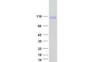Western Blotting (WB) image for Sema Domain, Immunoglobulin Domain (Ig), Transmembrane Domain (TM) and Short Cytoplasmic Domain, (Semaphorin) 4B (SEMA4B) (Transcript Variant 1) protein (Myc-DYKDDDDK Tag) (ABIN2731621)