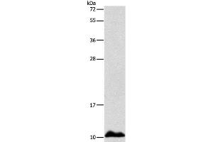 Western Blot analysis of Human fetal liver tissue using APOC1 Polyclonal Antibody at dilution of 1:500 (APOC1 抗体)