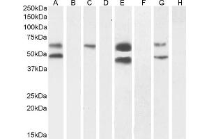 (ABIN570984) (1 μg/mL) staining of Human Cerebral Cortex (A) + peptide (B), (0. (CaMKII alpha/beta (Internal Region) 抗体)