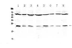 Western blot analysis of IL1RA using anti-IL1RA antibody . (IL1RN 抗体  (AA 26-177))