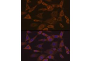 Immunofluorescence analysis of NIH-3T3 cells using Ephrin  Rabbit mAb (ABIN7266976) at dilution of 1:100 (40x lens). (Ephrin A1 抗体)