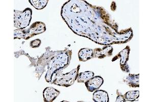 IHC analysis of CSNK2K2 using anti-CSNK2K2 antibody (ABIN7602871).