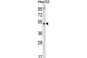 Western Blotting (WB) image for anti-Matrix Metalloproteinase 20 (MMP20) antibody (ABIN2997607) (MMP20 抗体)
