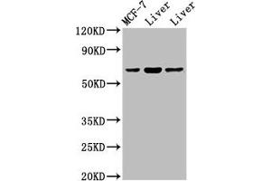 Western Blot Positive WB detected in: Rat liver tissue, Mouse liver issue All lanes: PTH1R antibody at 2 μg/mL Secondary Goat polyclonal to rabbit IgG at 1/50000 dilution Predicted band size: 67 kDa Observed band size: 67 kDa (PTH1R 抗体  (AA 485-593))