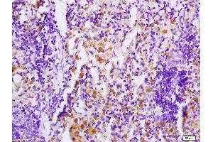 Formalin-fixed and paraffin embedded rat skin tissue tissue labeled with Anti PHOSPHO-MAP4K1(SER171) Polyclonal Antibody,Unconjugated  at 1:200 followed by conjugation to the secondary antibody and DAB staining. (MAP4K1 抗体  (pSer171))