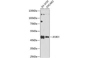 Western blot analysis of extracts of various cell lines using ANKH Polyclonal Antibody at dilution of 1:1000. (ANKH 抗体)