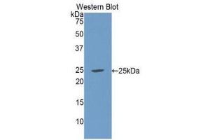 Western Blotting (WB) image for anti-Complement Component 1, Q Subcomponent Binding Protein (C1QBP) (AA 76-282) antibody (ABIN1078149)
