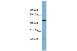 WB Suggested Anti-UCHL5IP Antibody Titration: 0. (HAUS7 抗体  (Middle Region))