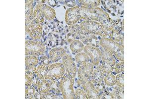 Immunohistochemistry of paraffin-embedded rat kidney using AP2A1 Antibody (ABIN5975765) at dilution of 1/100 (40x lens). (alpha Adaptin 抗体)