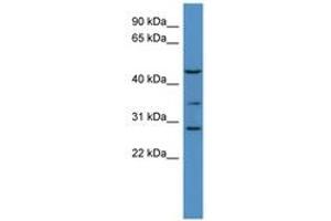 Image no. 1 for anti-UDP-Gal:betaGlcNAc beta 1,3-Galactosyltransferase, Polypeptide 2 (B3GALT2) (AA 352-401) antibody (ABIN6746259)