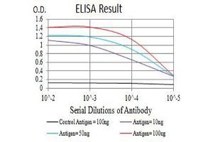 Black line: Control Antigen (100 ng),Purple line: Antigen (10 ng), Blue line: Antigen (50 ng), Red line:Antigen (100 ng) (PSMA 抗体  (AA 44-177))