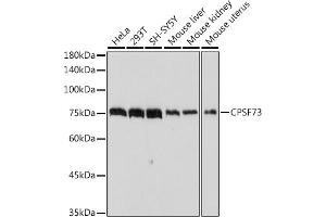 Western blot analysis of extracts of various cell lines, using CPSF73 antibody (ABIN3015868, ABIN3015869, ABIN1679207, ABIN1679208 and ABIN7101452) at 1:1000 dilution. (CPSF3 抗体)