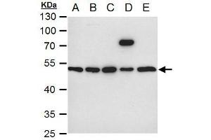 WB Image ILK antibody [N1C1] detects ILK protein by western blot analysis.