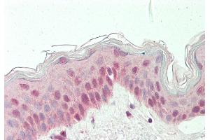 Rabbit Anti-RARG antibody  Formalin Fixed Paraffin Embedded Tissue: Human Skin Primary antibody Concentration: 1:100 Secondary Antibody: Donkey anti-Rabbit-Cy3 Secondary Antibody Concentration: 1:200 Magnification: 20x Exposure Time: 0. (Retinoic Acid Receptor gamma 抗体  (N-Term))