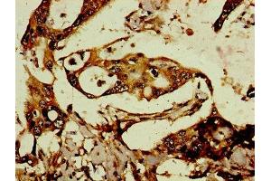 anti-Retrotransposon Gag-Like Protein 8B (RTL8C) (AA 1-113) antibody