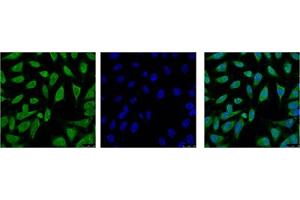 Immunofluorescence staining of HeLa cell line with antibody (Left), DAPI (Middle) and merge (Right).