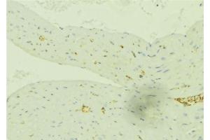 ABIN6276491 at 1/100 staining Mouse liver tissue by IHC-P. (SLC27A2 抗体  (N-Term))