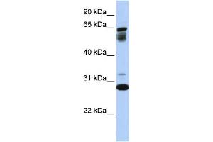 WB Suggested Anti-TMEM187  Antibody Titration: 0. (TMEM187 抗体  (Middle Region))