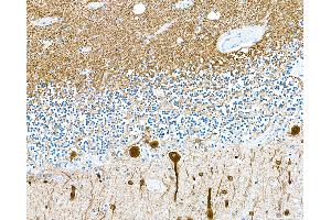 Immunohistochemistry (IHC) image for anti-Tubulin, beta 3 (TUBB3) (AA 400-450) antibody (ABIN7453957) (Recombinant TUBB3 抗体  (AA 400-450))