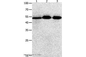Western blot analysis of Human lymphoma , ovarian and  colon cancer tissue  , using KLF5 Polyclonal Antibody at dilution of 1:350