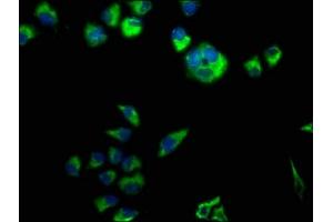 Immunofluorescence staining of Hela cells with ABIN7146593 at 1:50, counter-stained with DAPI. (Calsyntenin 3 抗体  (AA 197-408))