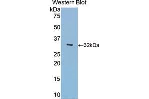 Western blot analysis of the recombinant protein. (MGEA5 抗体  (AA 319-450))