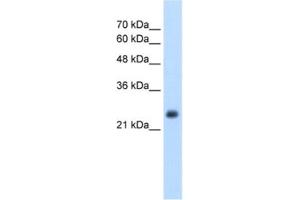 Western Blotting (WB) image for anti-Nicotinamide N-Methyltransferase (NNMT) antibody (ABIN2462559) (NNMT 抗体)