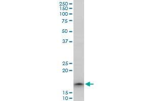 TOMM22 polyclonal antibody (A01), Lot # 051206JC01. (TOMM22 抗体  (AA 1-142))