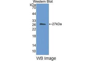 WB of Protein Standard: different control antibodies against Highly purified E. (CETP ELISA 试剂盒)