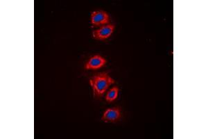 Immunofluorescent analysis of RPS6 (pS240) staining in HeLa cells. (RPS6 抗体  (C-Term, pSer240))