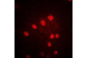 Immunofluorescent analysis of POLR1D staining in MCF7 cells. (POLR1D 抗体)