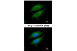 ICC/IF Image Immunofluorescence analysis of paraformaldehyde-fixed HeLa, using DPRP1 , antibody at 1:200 dilution. (DPP8 抗体  (N-Term))