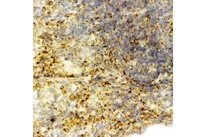 Anti-Caspase-6(P18) antibody,  IHC(F) IHC(F): Rat Spleen Tissue (Caspase 6 抗体  (N-Term))