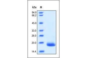 SDS-PAGE (SDS) image for Colony Stimulating Factor 3 (Granulocyte) (CSF3) (AA 31-204) (Active) protein (ABIN2181135)