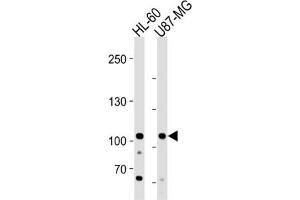 Western Blotting (WB) image for anti-MORC Family CW-Type Zinc Finger 3 (MORC3) antibody (ABIN3004591) (MORC3 抗体)