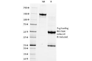 SDS-PAGE Analysis Purified CD5 Monoclonal Antibody (CRIS-1). (CD5 抗体)