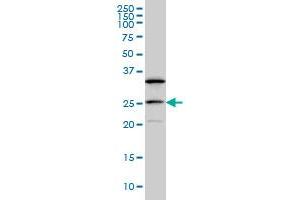 Western Blotting (WB) image for anti-dephospho-CoA Kinase Domain Containing (DCAKD) (AA 113-201) antibody (ABIN466243) (DCAKD 抗体  (AA 113-201))