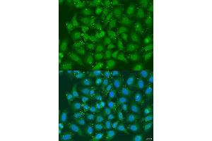 Immunofluorescence analysis of U2OS cells using XBP1 antibody. (XBP1 抗体  (AA 1-261))