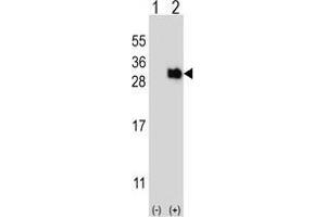 Western blot analysis of UBTD1 (arrow) using rabbit polyclonal UBTD1 Antibody . (UBTD1 抗体)