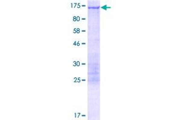 CLIP2 Protein (AA 1-1046) (GST tag)