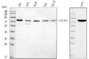 Western blot analysis of Caldesmon using anti-Caldesmon antibody (ABIN4886498). (Caldesmon 抗体  (AA 1-120))