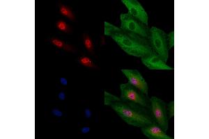 ABIN7094659 and ABIN7098710 staining  cells by IF/ICC. (TCF21 抗体  (Internal Region))