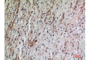 Immunohistochemistry (IHC) analysis of paraffin-embedded Human Brain, antibody was diluted at 1:100.