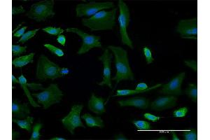 Immunofluorescence of monoclonal antibody to GBF1 on HeLa cell. (GBF1 抗体  (AA 101-209))