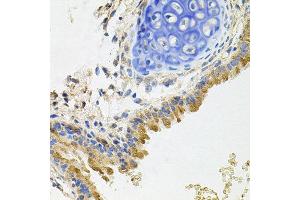 Immunohistochemistry of paraffin-embedded mouse lung using GP2 antibody at dilution of 1:100 (x40 lens).