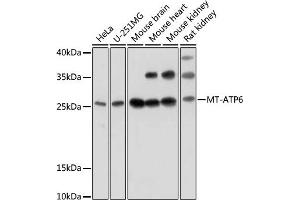 Western blot analysis of extracts of various cell lines, using MT- antibody (ABIN7268592) at 1:1000 dilution. (MT-ATP6 抗体)