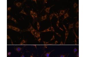 Immunofluorescence analysis of C6 cells using UBE2J1 Polyclonal Antibody at dilution of 1:100. (UBE2J1 抗体)
