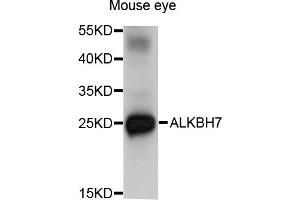 Western blot analysis of extracts of mouse eye, using ALKBH7 antibody (ABIN5971299) at 1/1000 dilution. (ALKBH7 抗体)