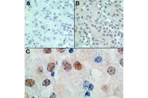 Image no. 1 for anti-Msh Homeobox 1 (MSX1) (AA 50-100) antibody (ABIN207744) (MSX1 抗体  (AA 50-100))