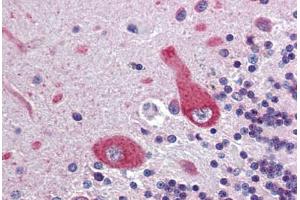 Brain, cerebellum, Human: Formalin-Fixed, Paraffin-Embedded (FFPE) (Ankyrin G 抗体  (AA 1690-1701))